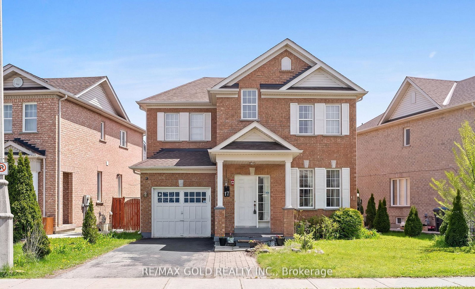 17-calderstone-road-brampton-ontario-w13668204
